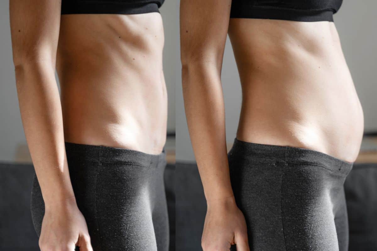How long does diastasis recti take to improve Wigan?
