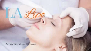 Woman receiving Actinic Keratosis Removal Treatment Wigan