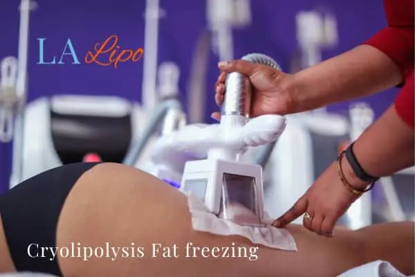 women getting fat freezing Wigan