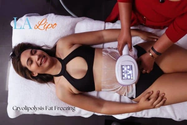woman getting cryolipolysis Wigan