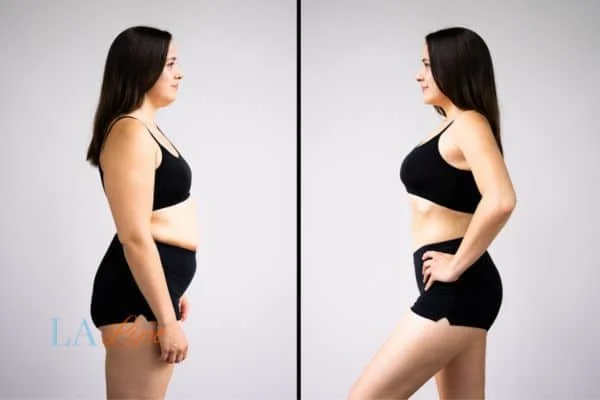 link between body image and mental health Wigan