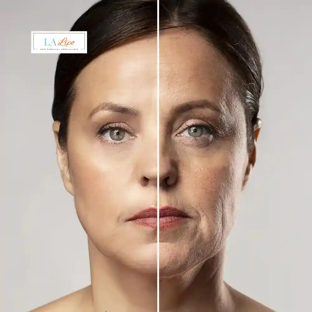 How Can You Tell If Non-Surgical Skin Tightening Is Right for You Wigan?