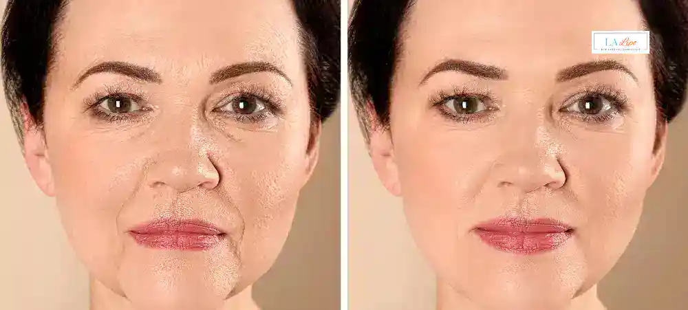 Why Aren’t My Skincare Products Making My Sagging Skin Look Firmer Wigan?